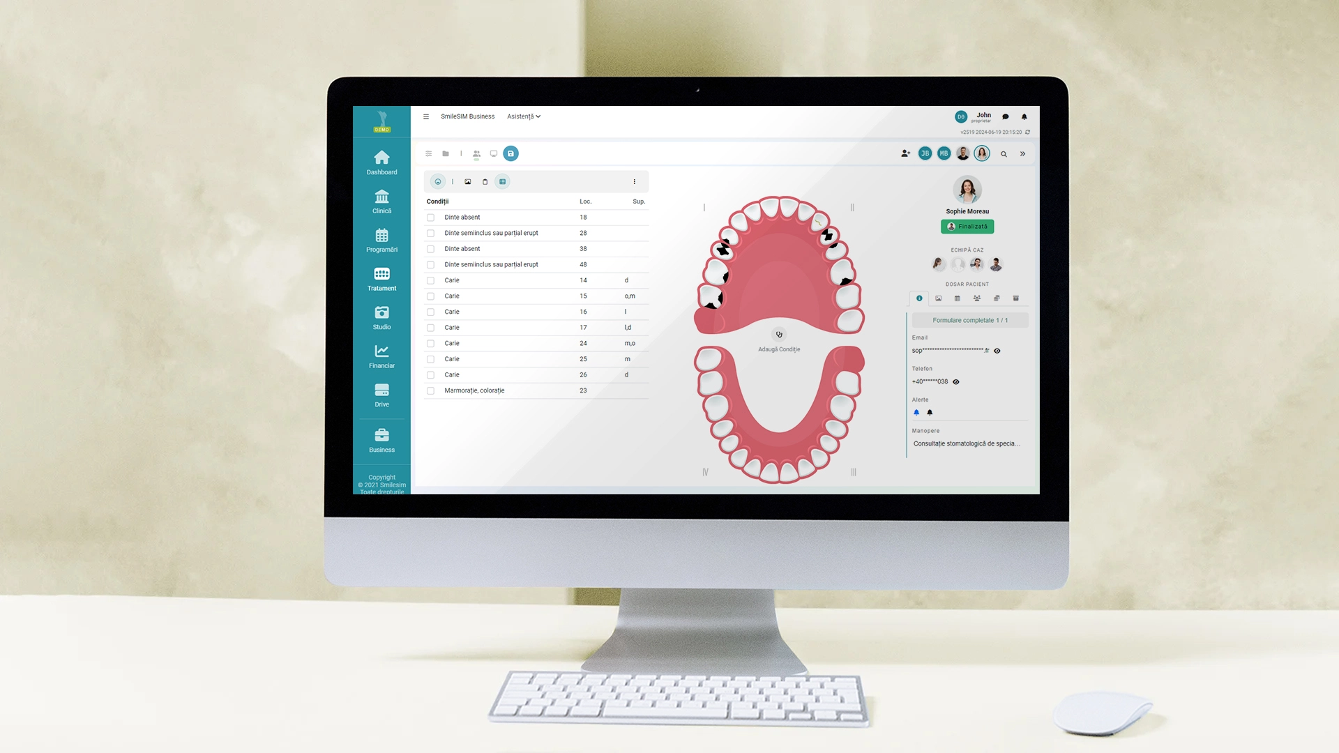 Previzualizarea caracteristiciilor aplicației software al modulului Plan de Tratament